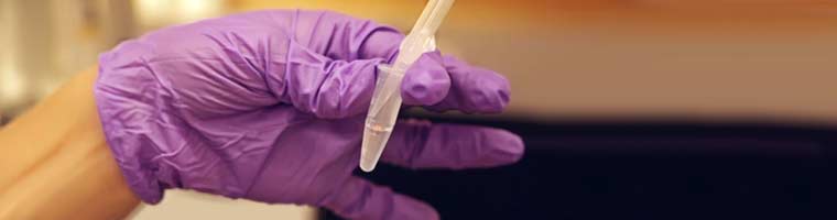 6 Tipps für eine perfekte Gelextraktion